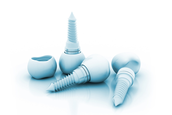 Benefits Of Dental Implants Compared With Traditional Dentures