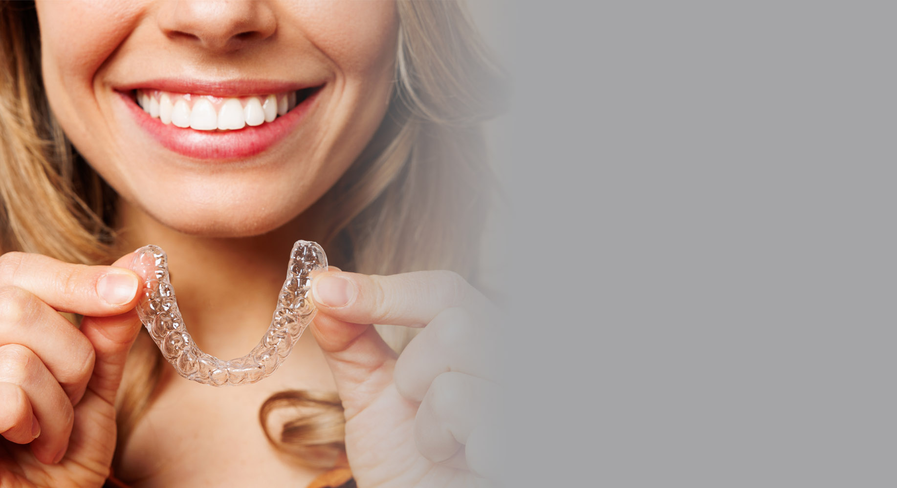 Invisalign 